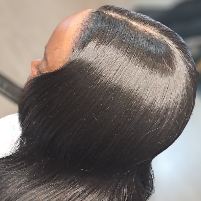 wig install