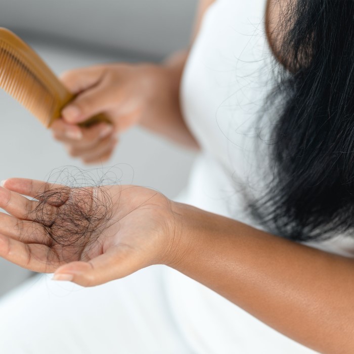 does metoprolol cause hair loss