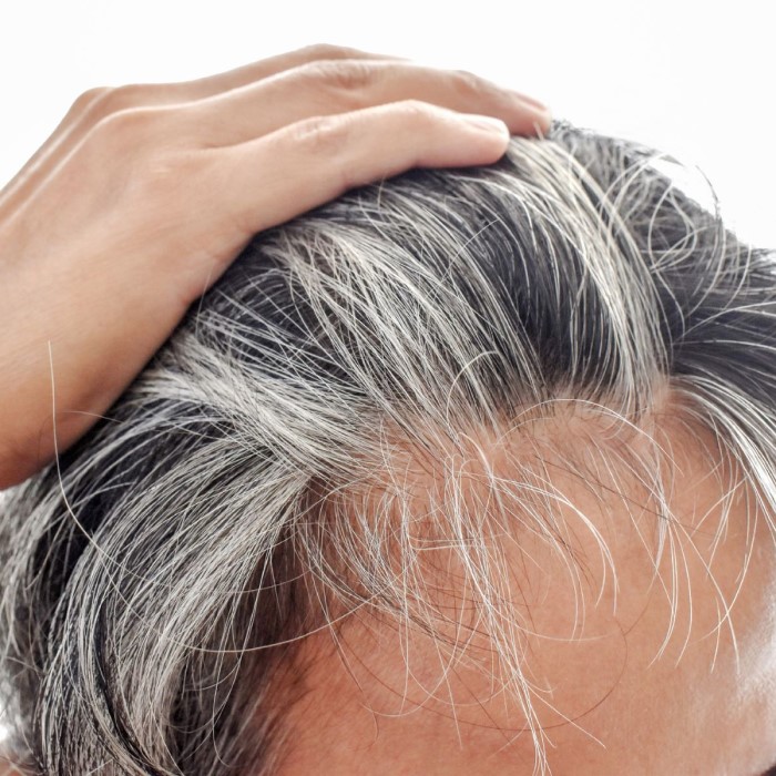 does radiation cause hair loss