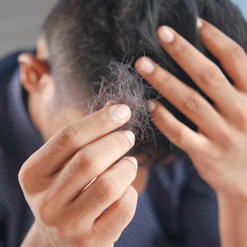 does high cortisol cause hair loss