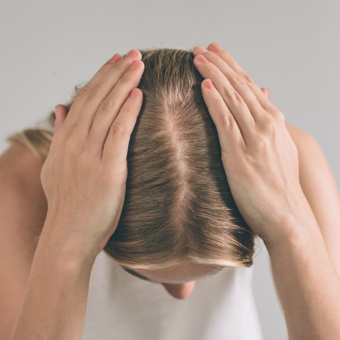can birth control cause hair loss