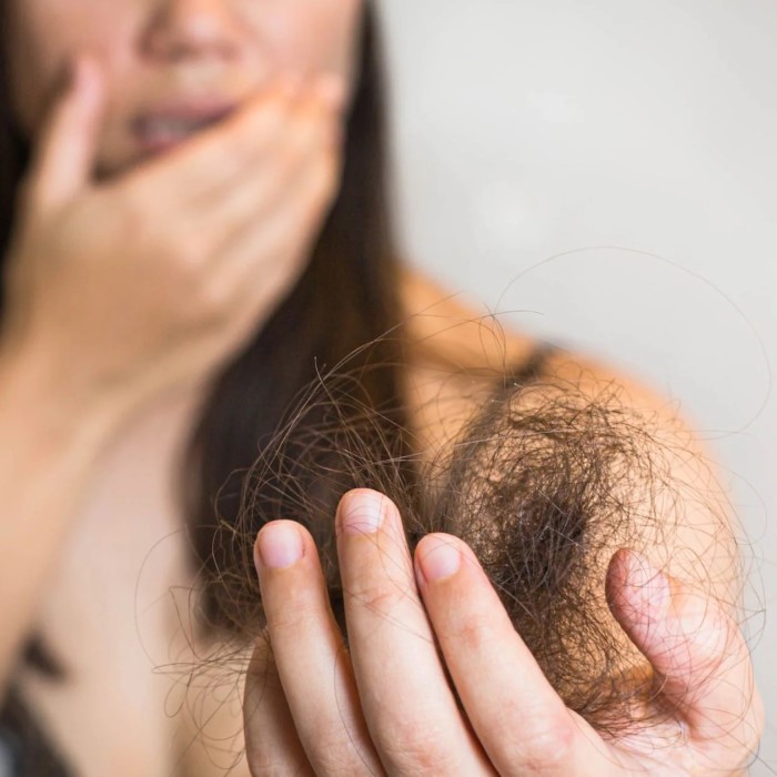 does metoprolol cause hair loss