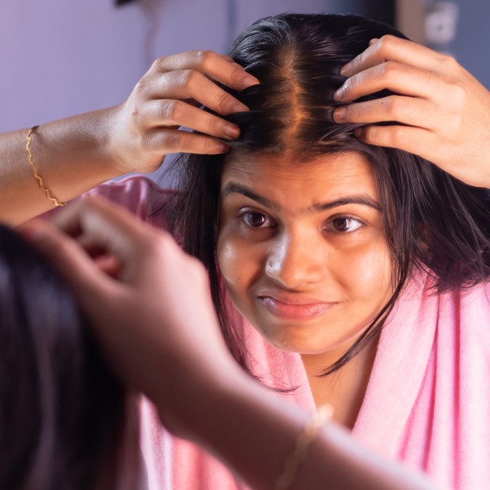 can birth control cause hair loss