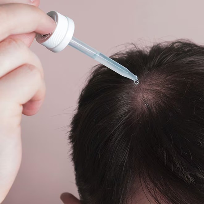 does radiation cause hair loss