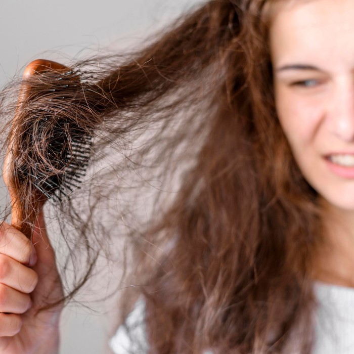 can dry shampoo cause hair loss