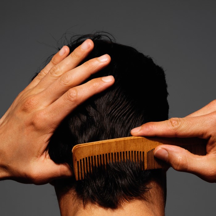 does creatine cause hair loss