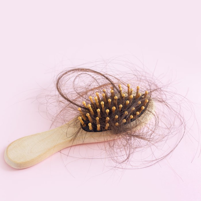 does weight loss cause hair loss