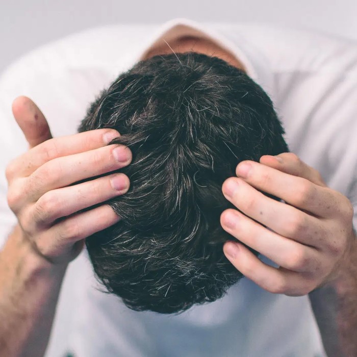 does creatine cause hair loss