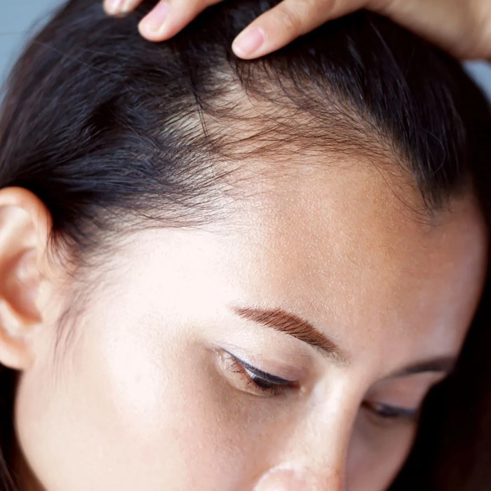 does radiation cause hair loss
