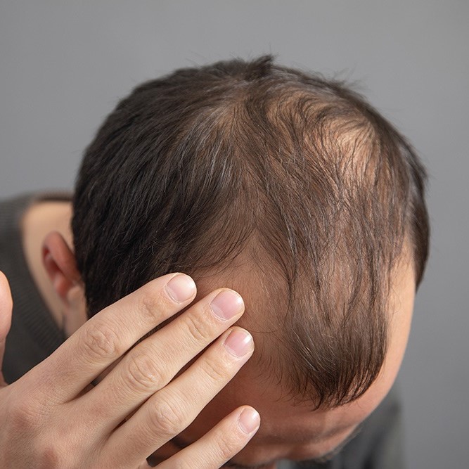 does diabetes cause hair loss