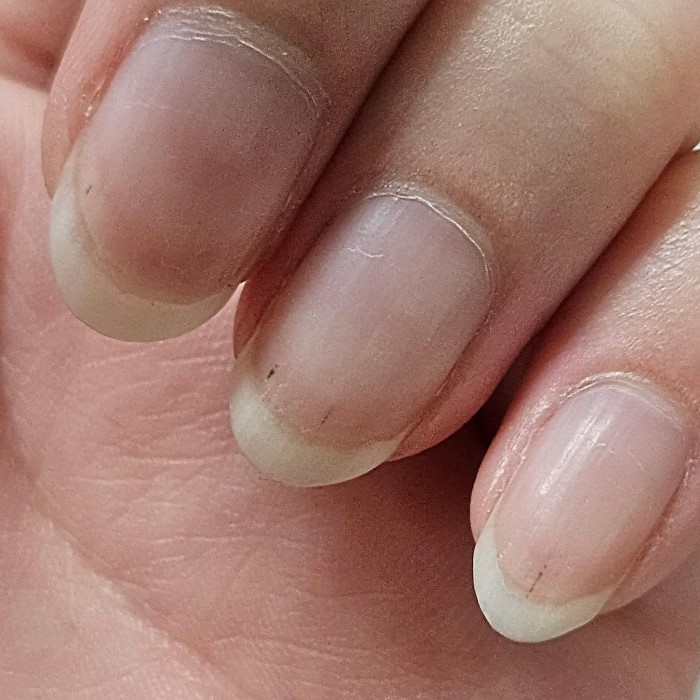 why is there a black line on my nail