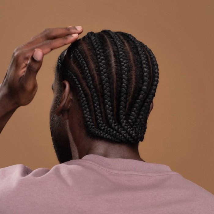 does phentermine cause hair loss