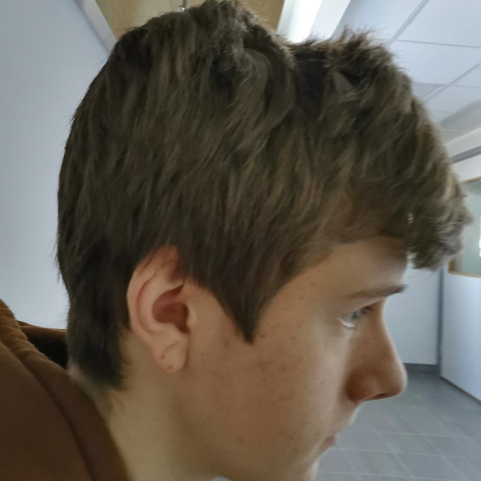 do headphones cause hair loss