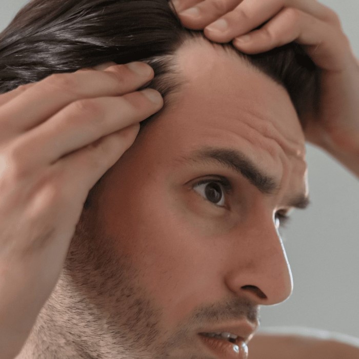 can high blood pressure cause hair loss