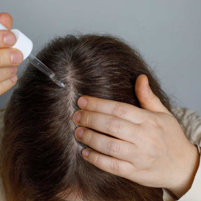 does lexapro cause hair loss