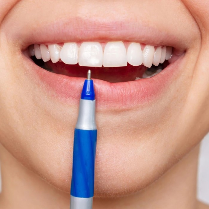 how to use whitening pen