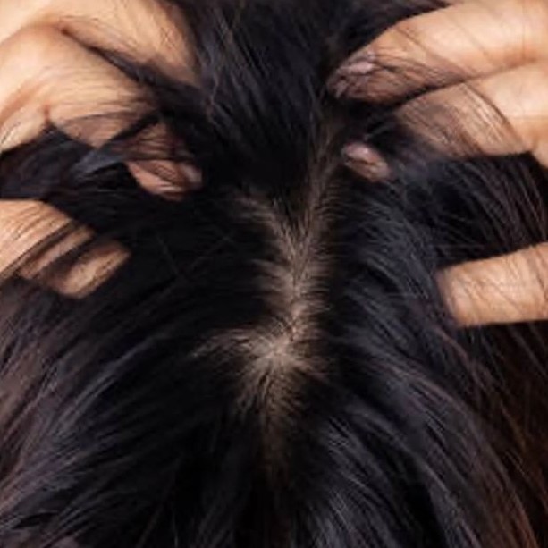 can low estrogen cause hair loss