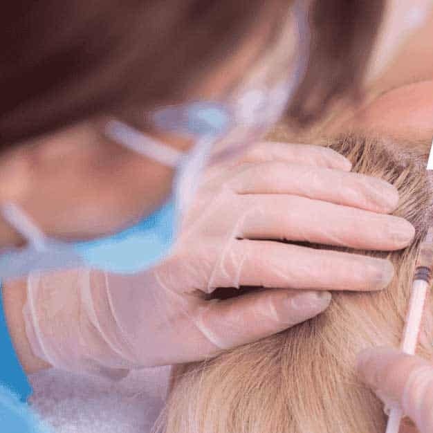 can anesthesia cause hair loss