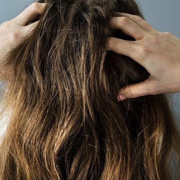 can long hair cause headaches