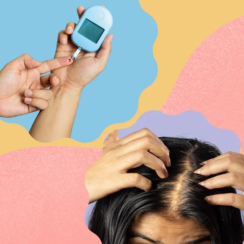 does diabetes cause hair loss