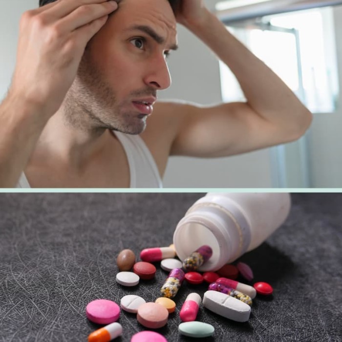 does phentermine cause hair loss