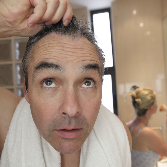 can high blood pressure cause hair loss