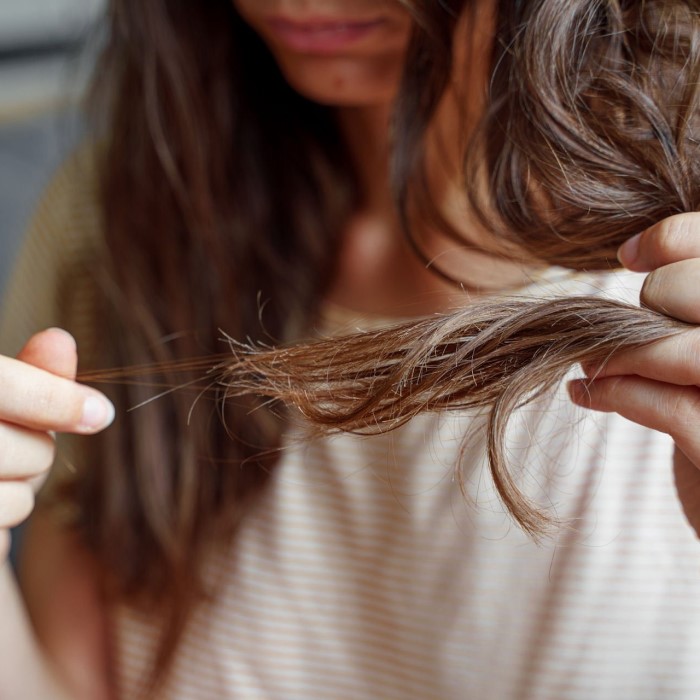 can weed cause hair loss