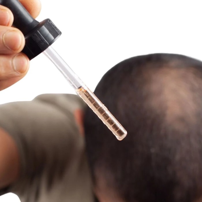 can rosemary oil cause hair loss
