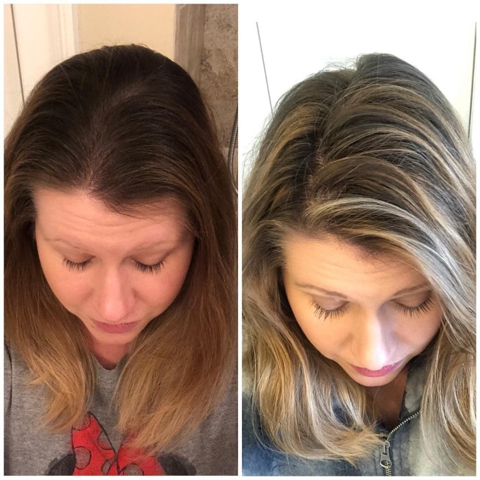 does hair dye cause hair loss