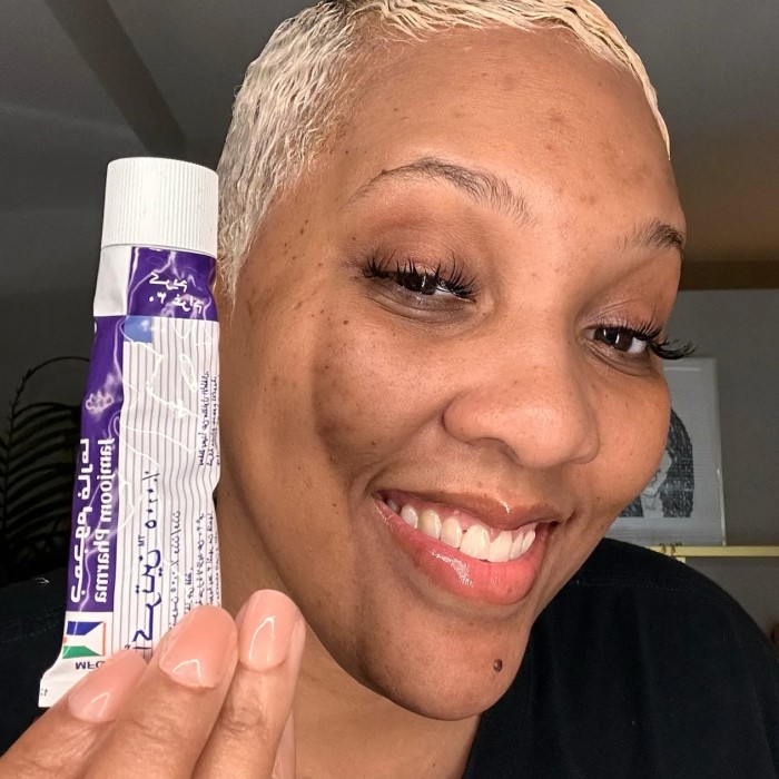 can tretinoin cause hair loss