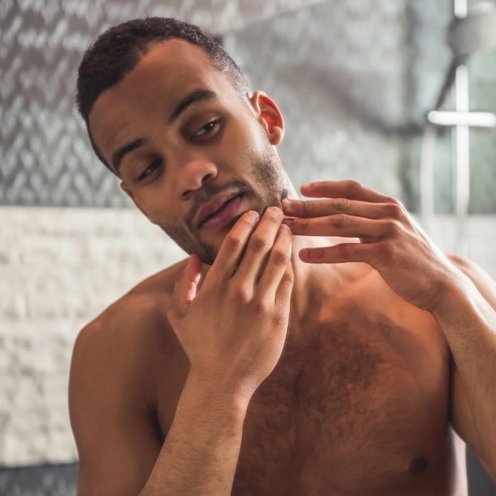 does facial hair cause acne