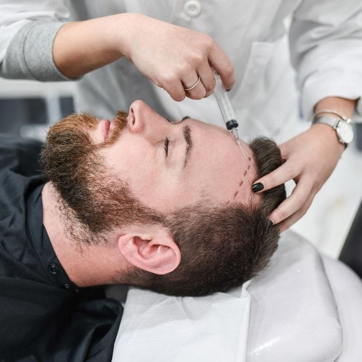 can anesthesia cause hair loss