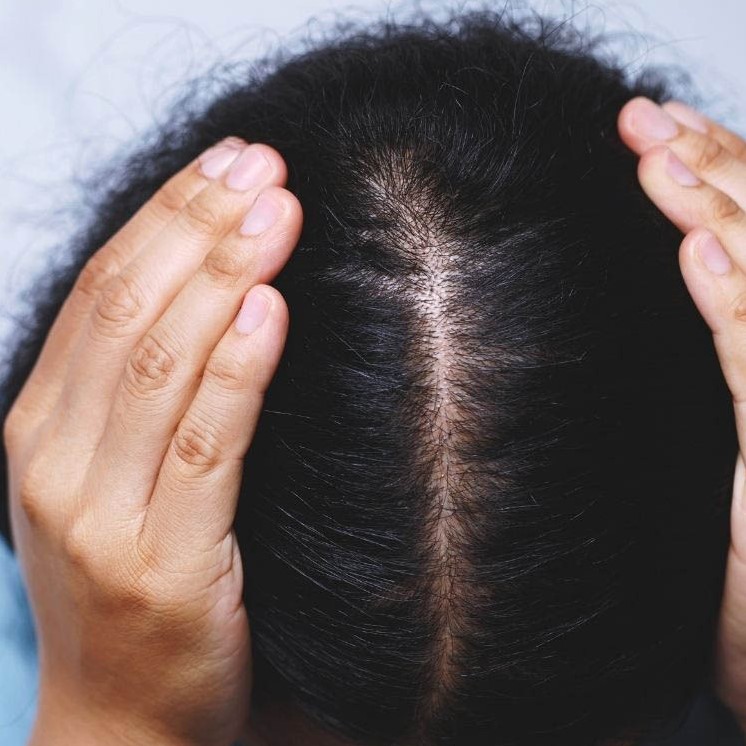 does menopause cause hair loss