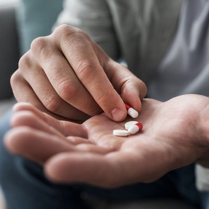 can wellbutrin cause hair loss