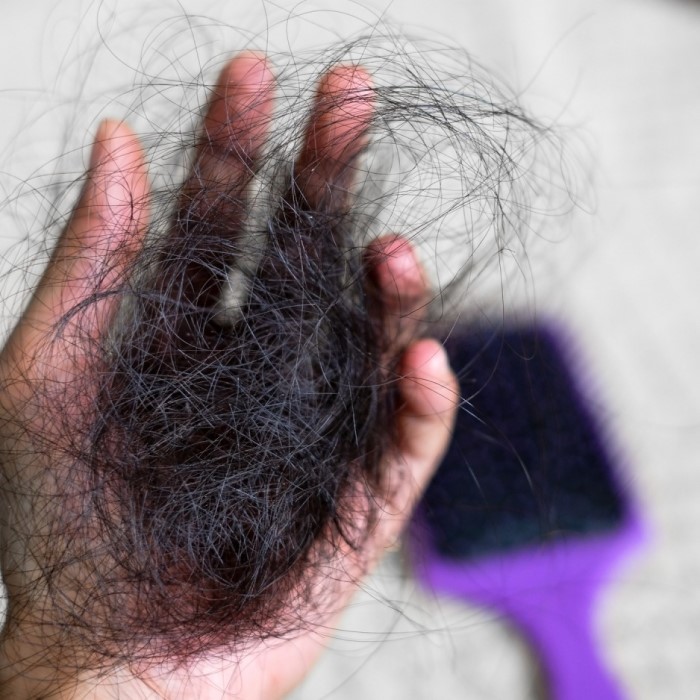 can vitamin deficiency cause hair loss