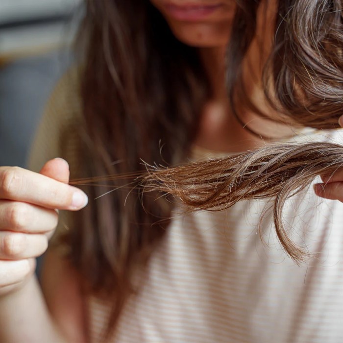 can vitamin deficiency cause hair loss