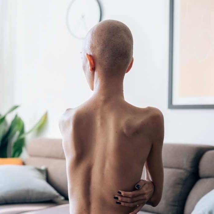 does masturbation cause hair loss