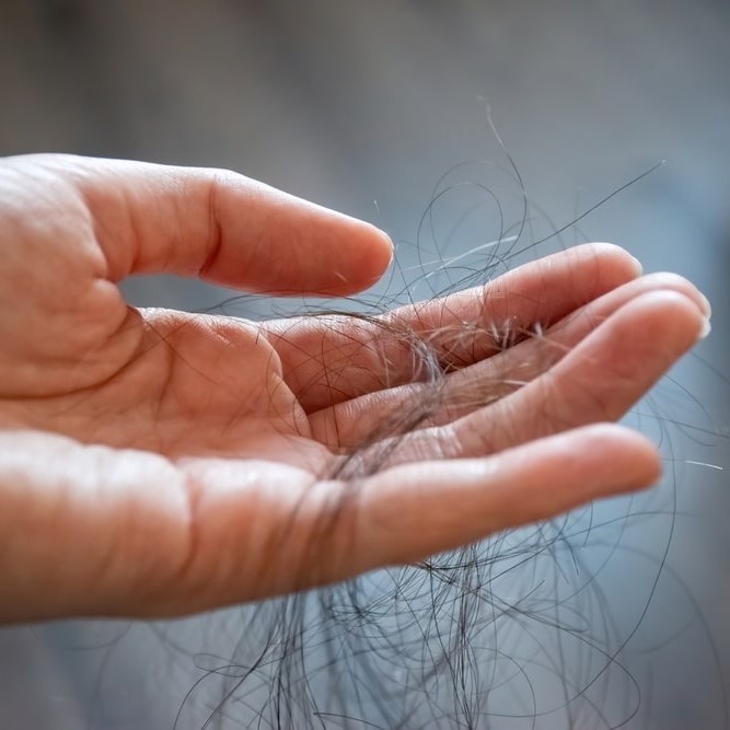 can pregnancy cause hair loss
