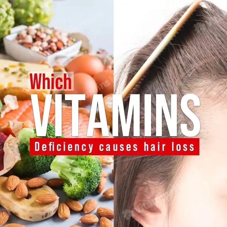 can vitamin deficiency cause hair loss