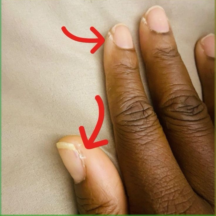 how to take off nail glue without acetone