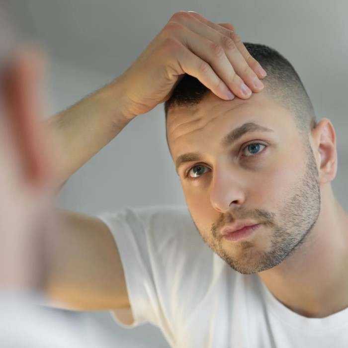 can energy drinks cause hair loss