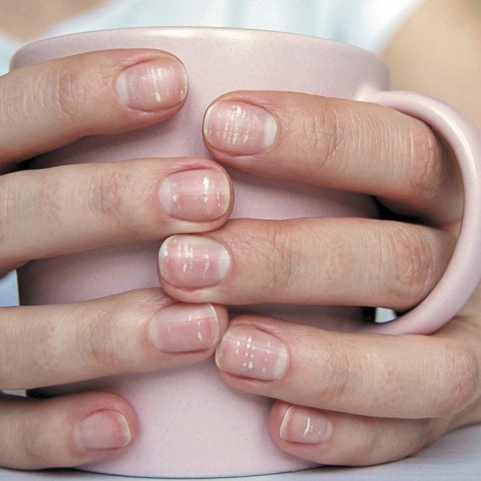 why is there a white spot on my nail