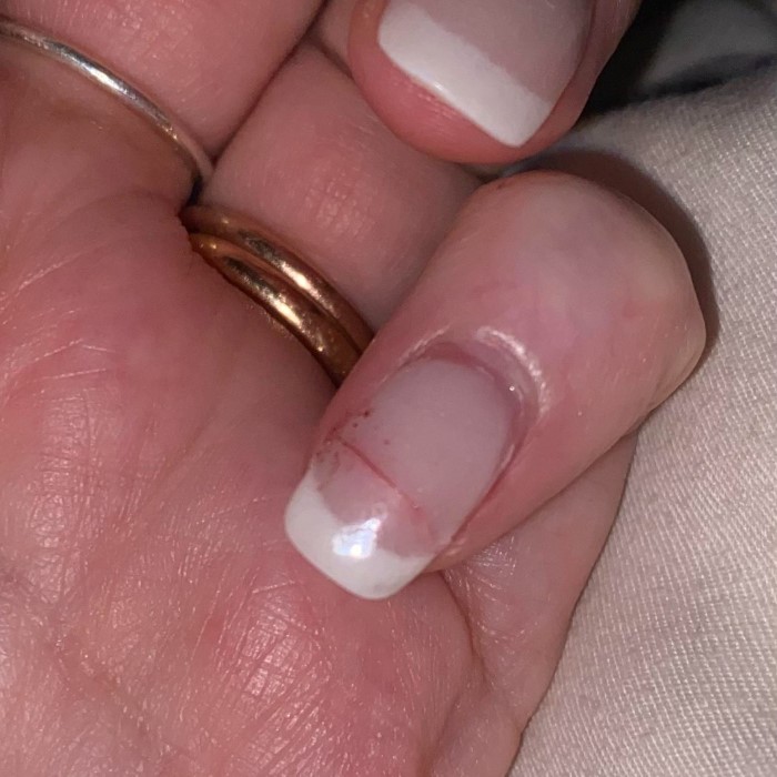 can i use super glue as nail glue