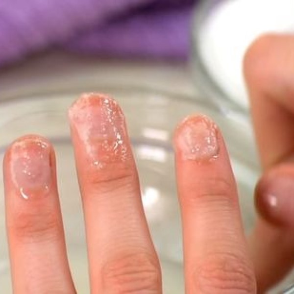 what removes nail glue from skin