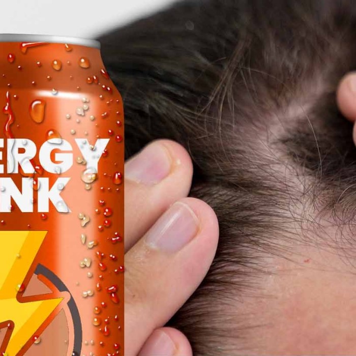 can energy drinks cause hair loss