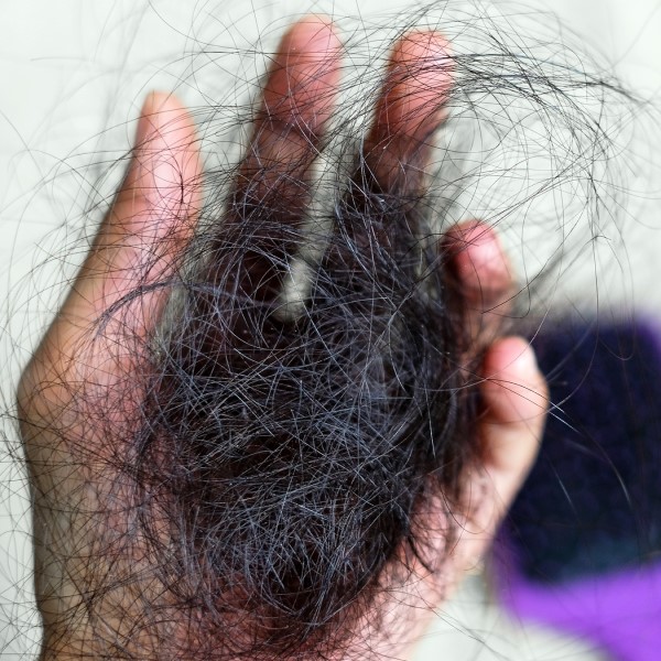 does pregnancy cause hair loss