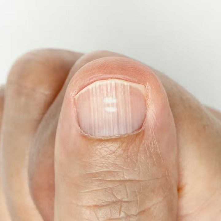 why is there a white spot on my nail