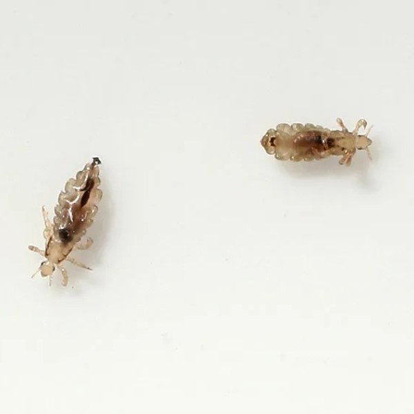 can lice cause hair loss