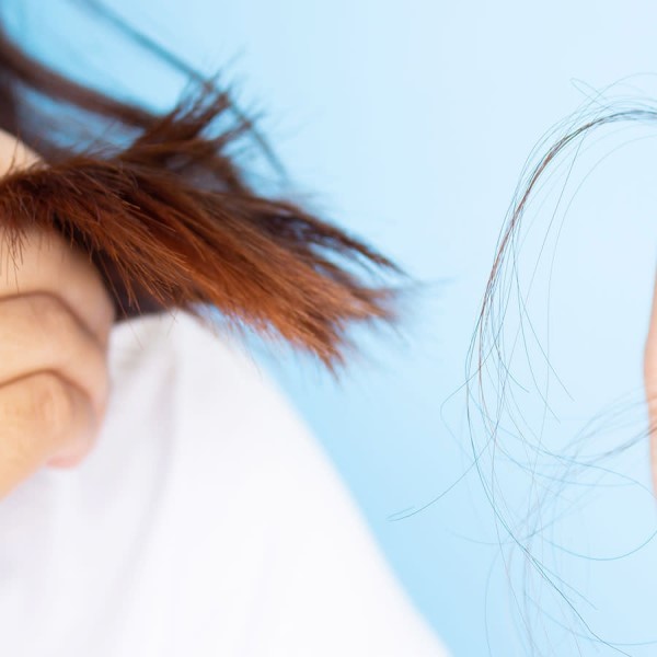 does estradiol cause hair loss