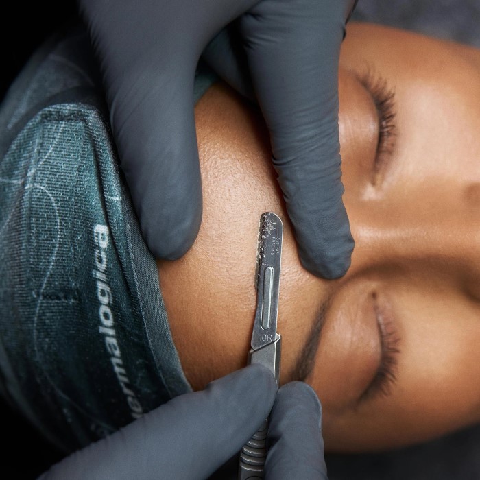 is dermaplaning good for your skin